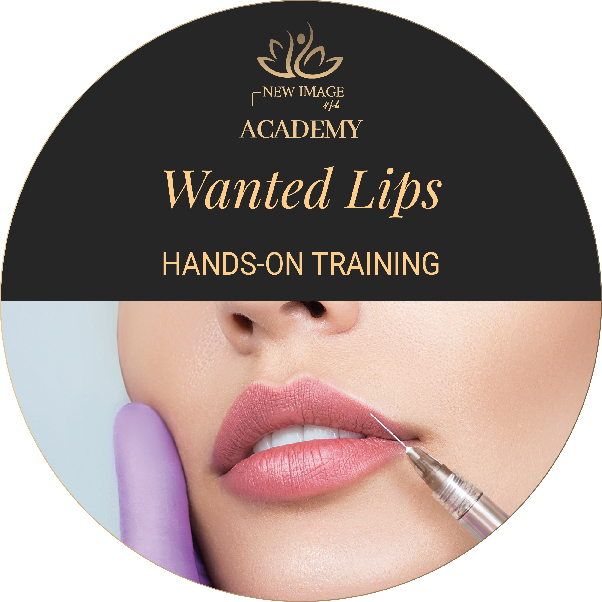 Wanted Lips